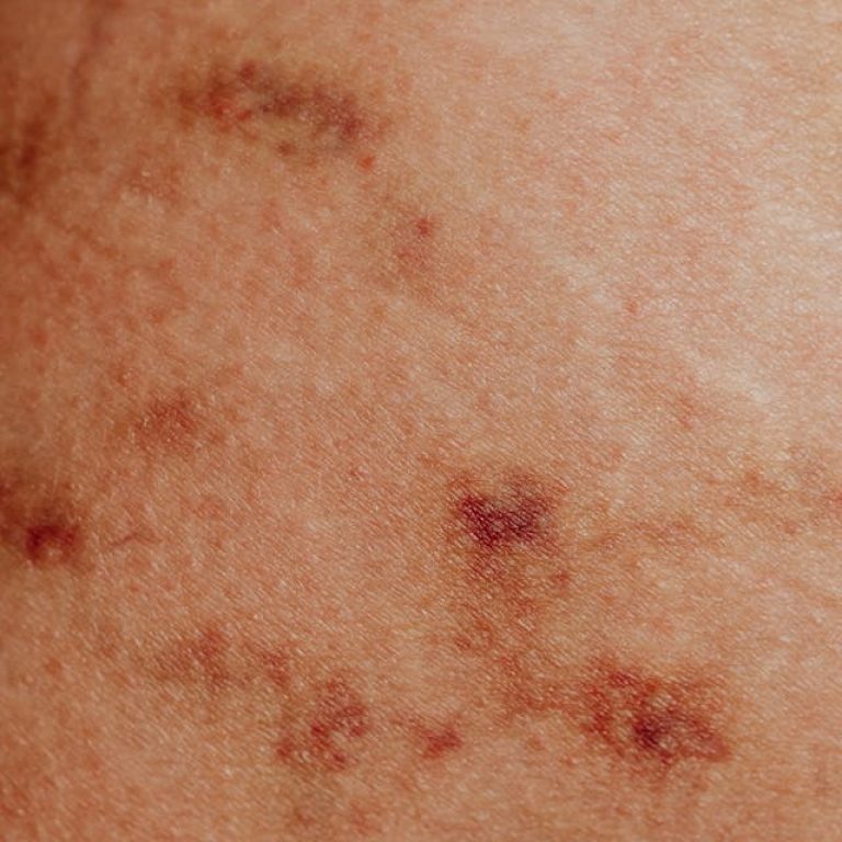 dermatologist near me