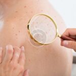 dermatologist near me