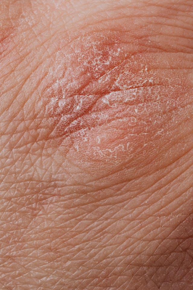 dermatologist near me