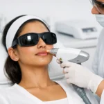 laser hair removal for face